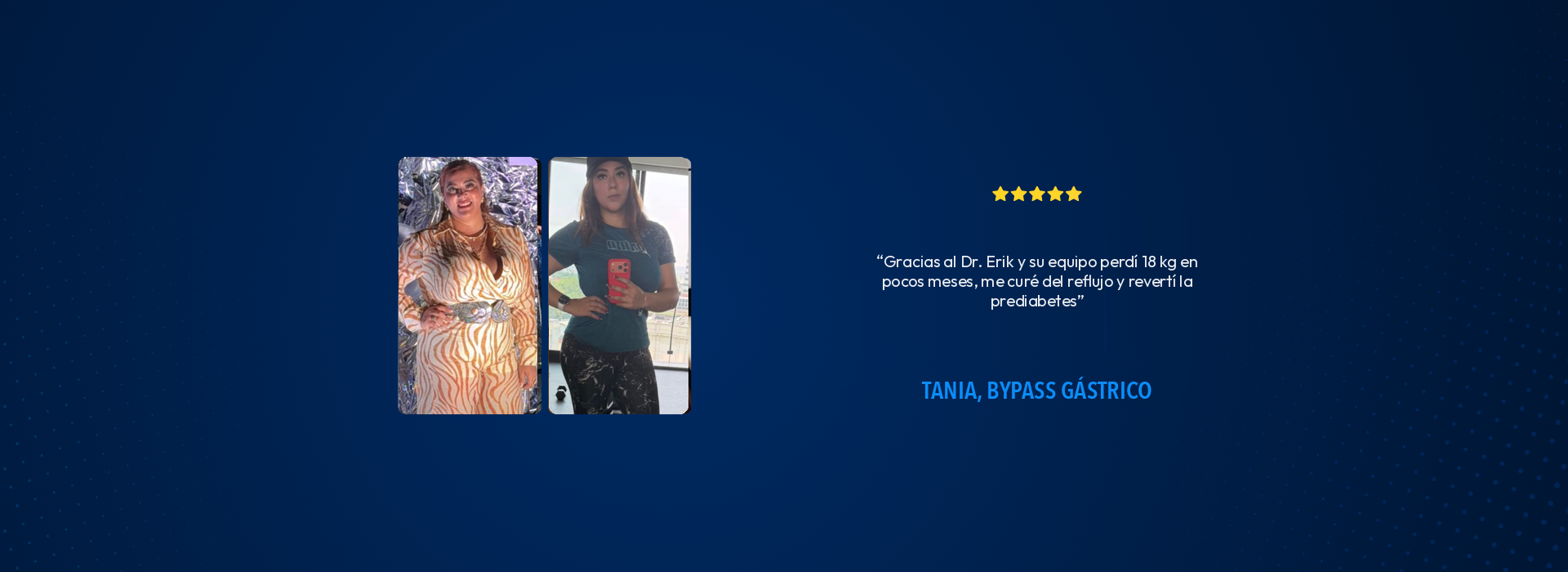Tania, Bypass Gástrico